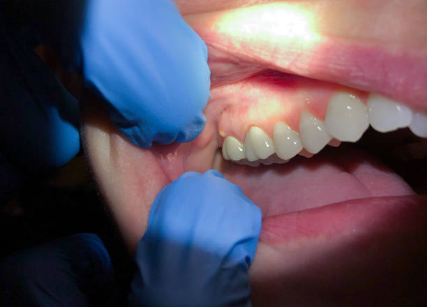 Best Broken Tooth Emergency  in La Conner, WA